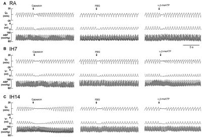 HIF-1α-Mediated, NADPH Oxidase-Derived ROS Contributes to Laryngeal Airway Hyperreactivity Induced by Intermittent Hypoxia in Rats